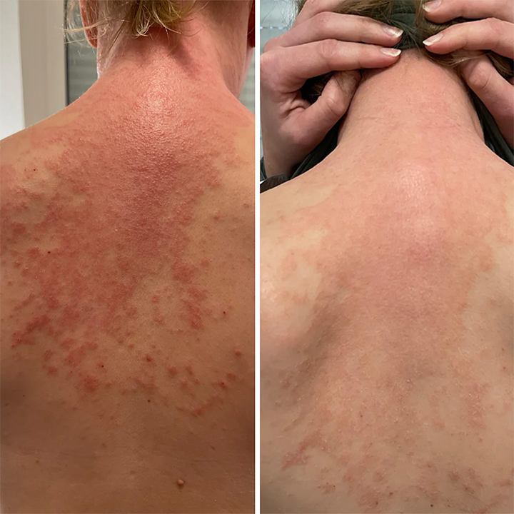 Miasaki Magnesium Skin Relief Spray