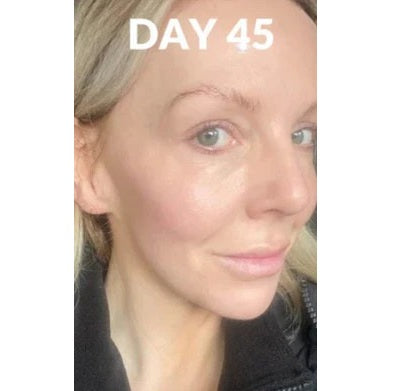 After