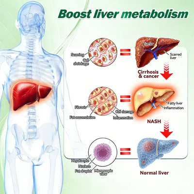 Liver Detox Support