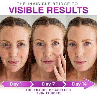Miasaki 3-in-1 Microneedle Anti-Aging Patch