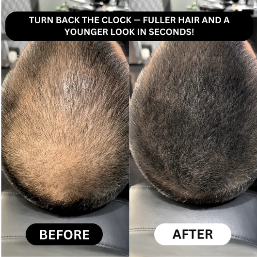 Miasaki Hair Density Filler