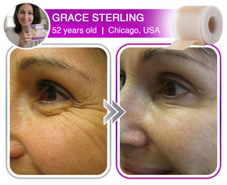 Miasaki 3-in-1 Microneedle Anti-Aging Patch