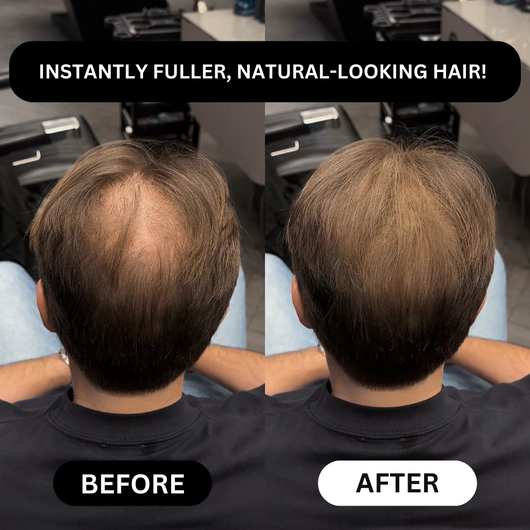 Miasaki Hair Density Filler