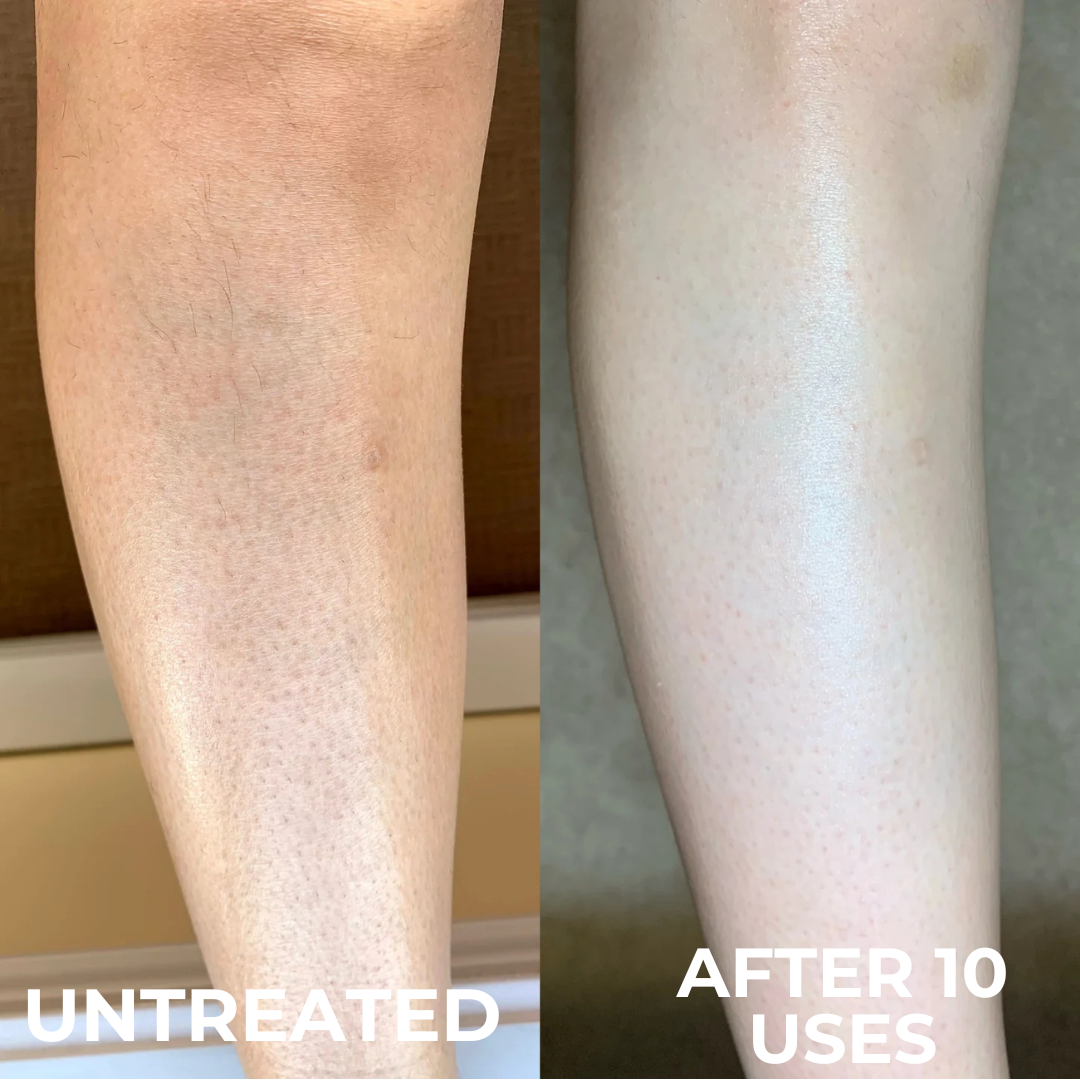 Miasaki Strawberry Skin Cream