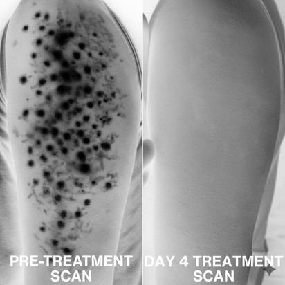 Miasaki Strawberry Skin Cream