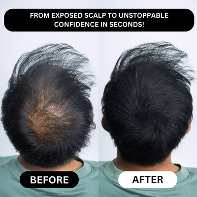Miasaki Hair Density Filler